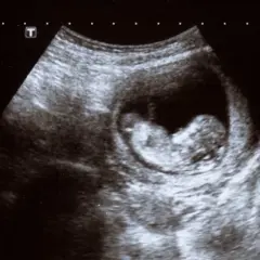 Jak wygląda dziecko w 7 tygodniu ciąży? Niesamowite zmiany w twoim brzuchu