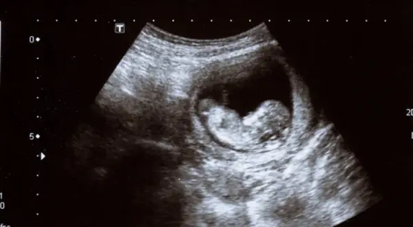 Jak wygląda dziecko w 7 tygodniu ciąży? Niesamowite zmiany w twoim brzuchu